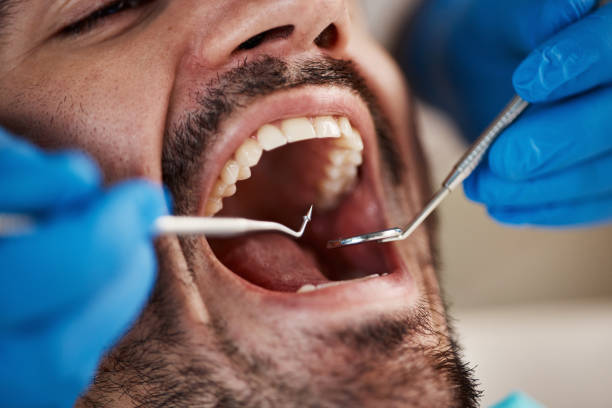 Best Same-Day Emergency Dental Services in Combee Settlement, FL
