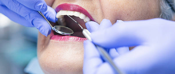 Best Emergency Tooth Extraction in Combee Settlement, FL